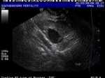 ultrasound picture
